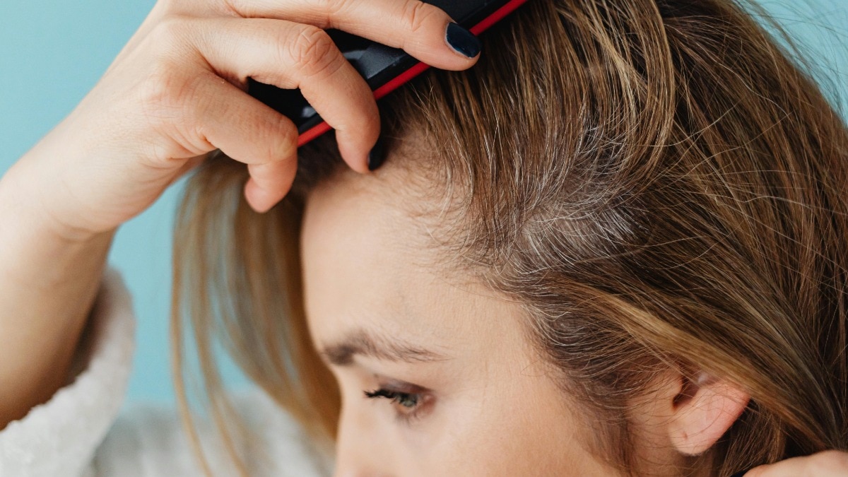 Are we focusing on scalp skin barrier enough?